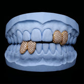 Iced-out Double cap grillz