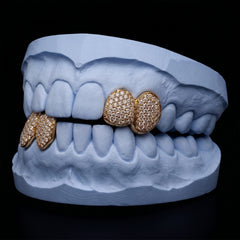 Iced-out Double cap grillz