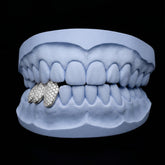 Iced triple cap grillz