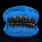 Black Rhodium Grillz