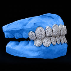 VVS Moissanite Diamond Grillz