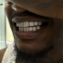 VVS Moissanite Diamond Grillz