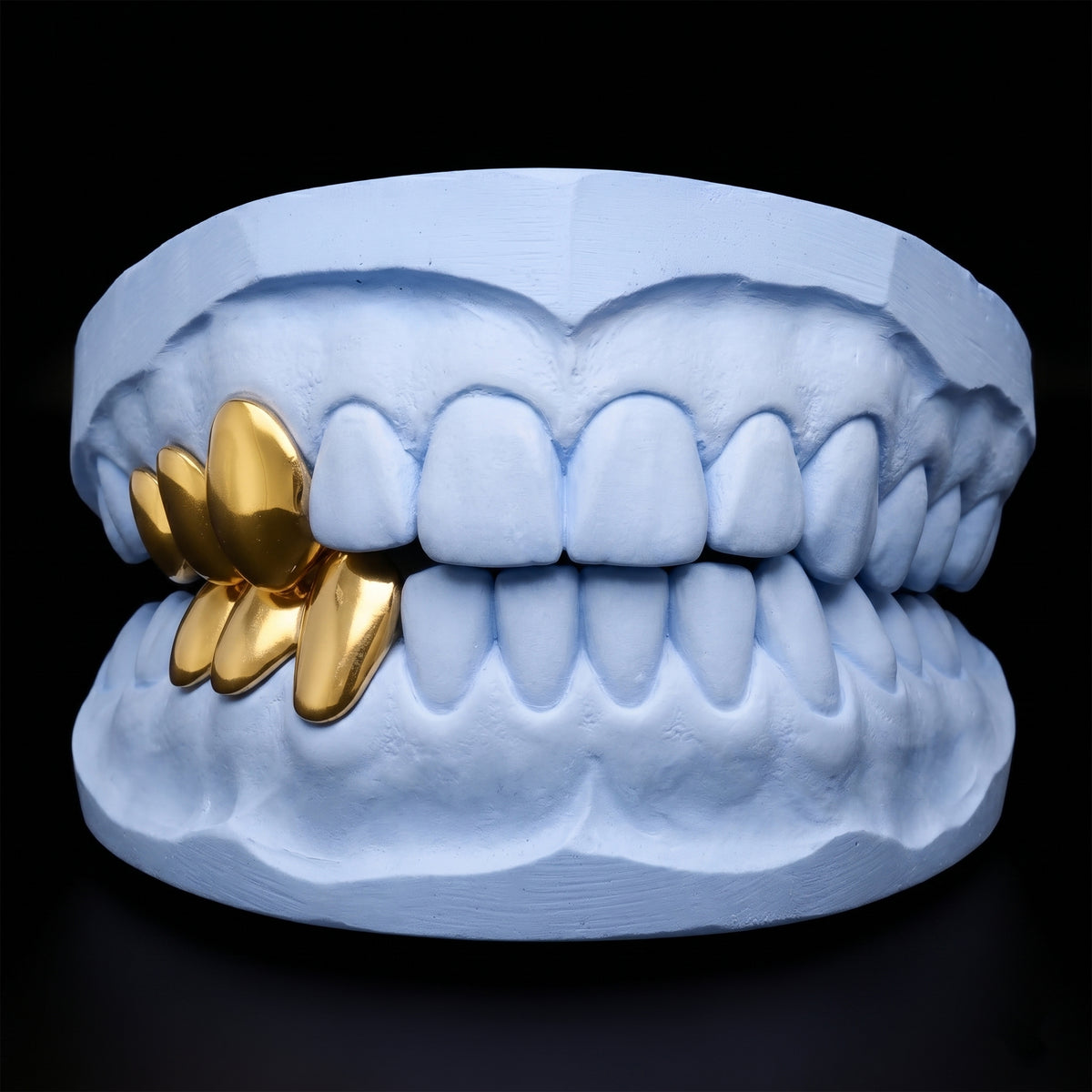 Solid triple cap Grillz
