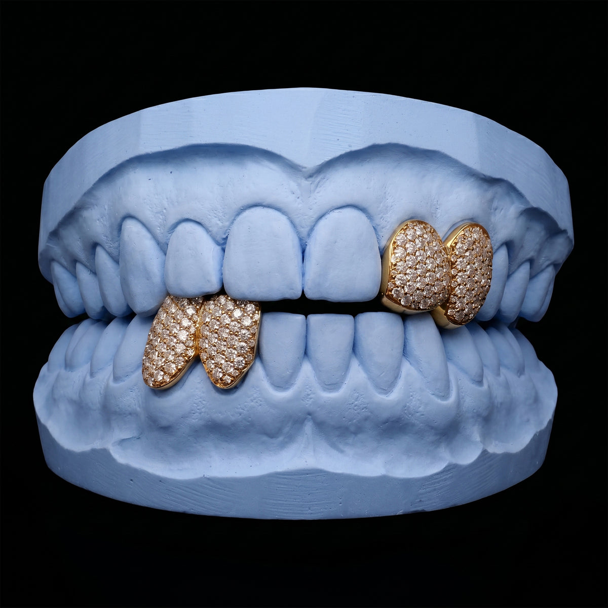 Iced-out Double cap grillz
