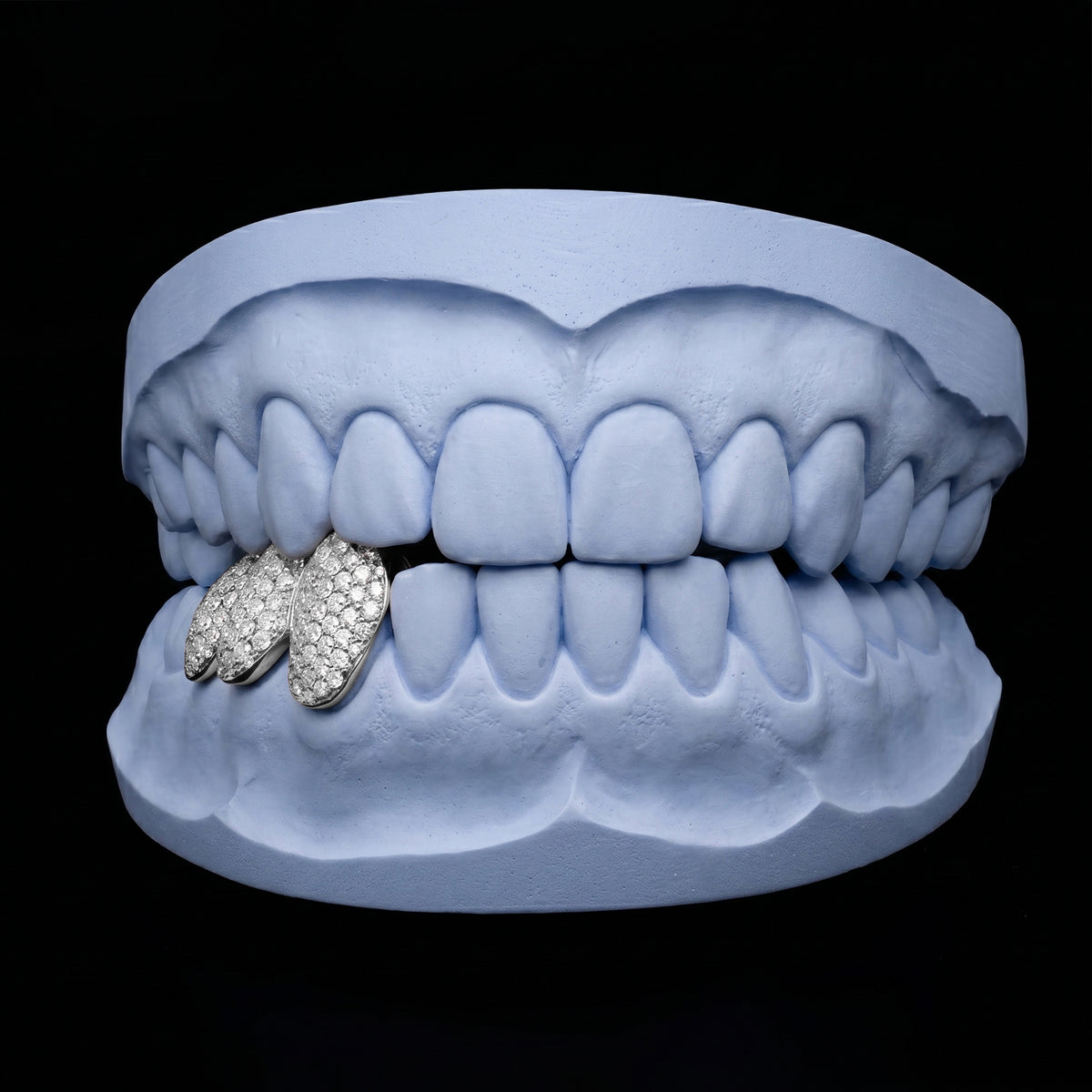Iced triple cap grillz