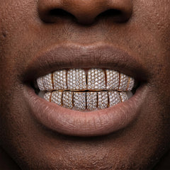 VVS Moissanite Diamond Grillz