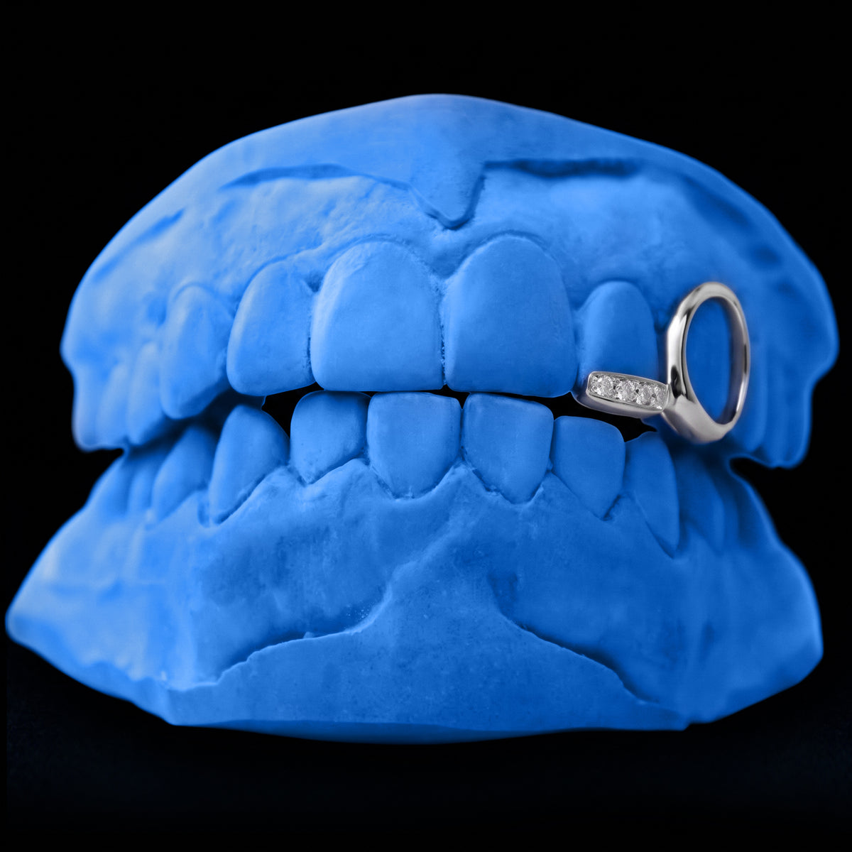 Iced-out Bridge & Window Grillz