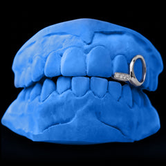 Iced-out Bridge & Window Grillz