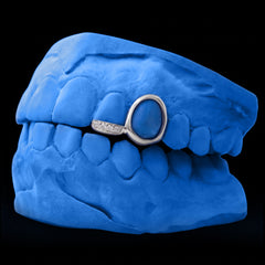 Iced-out Bridge & Window Grillz