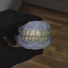 VVS Moissanite Diamond Grillz